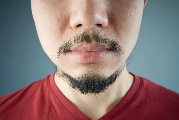 Beard Doesn't Connect To Moustache - Genetics