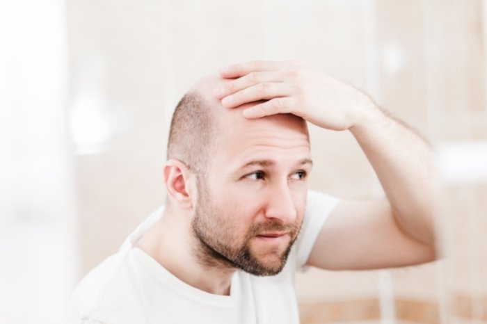 How To Choose The Best Haircut For Bald Spot On Crown