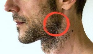 Beardresource Cowlick Article