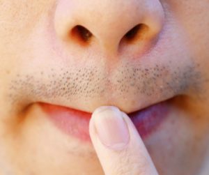 get rid of beard shadow