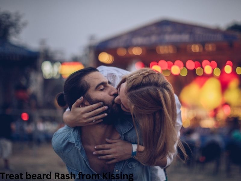 treat beard rash from kissing